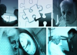 Alzheimer's disease - Disability Attorney